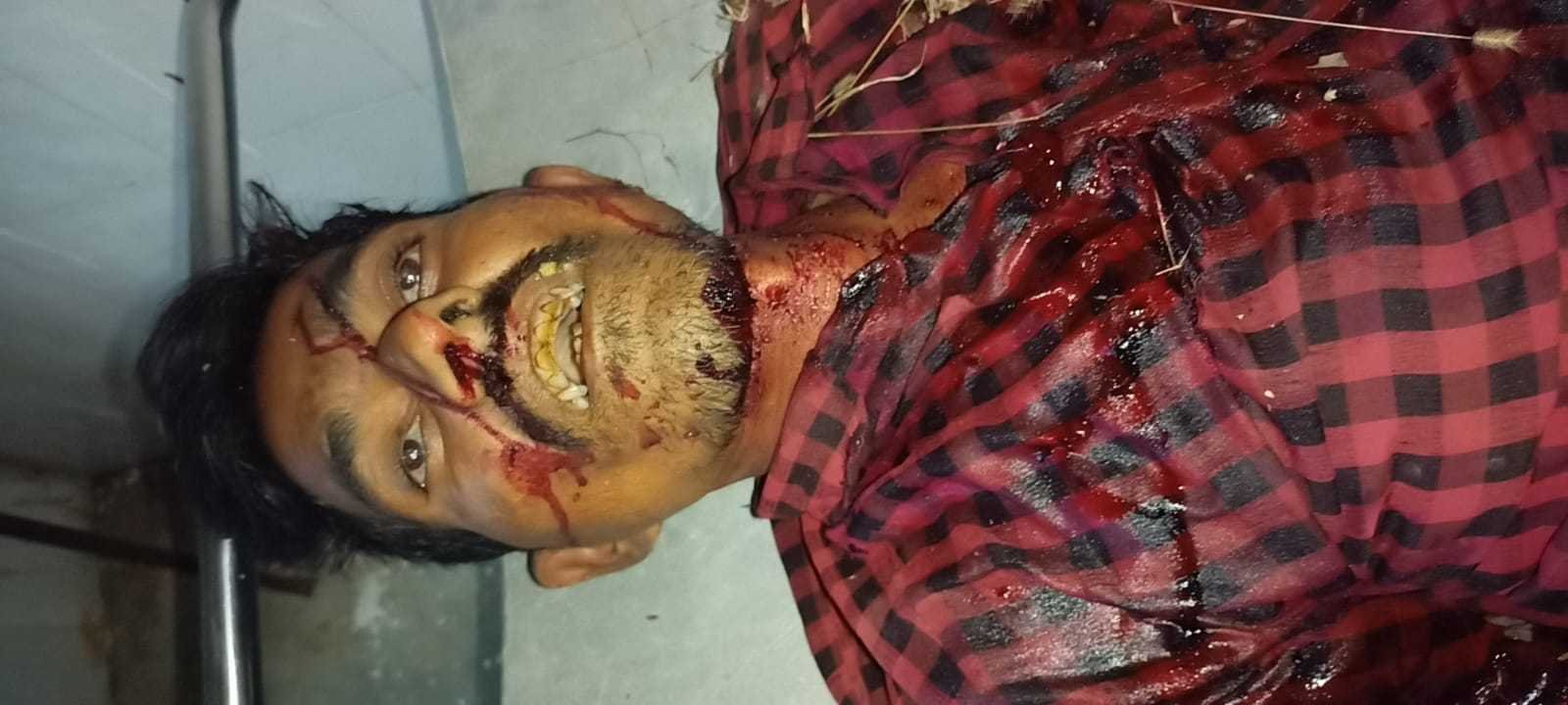 भेसदेही आठनेर रोड पर बडी पुलिया के पास मोटरसाइकिल टकराने से हुआ हादसा एक की मौत
