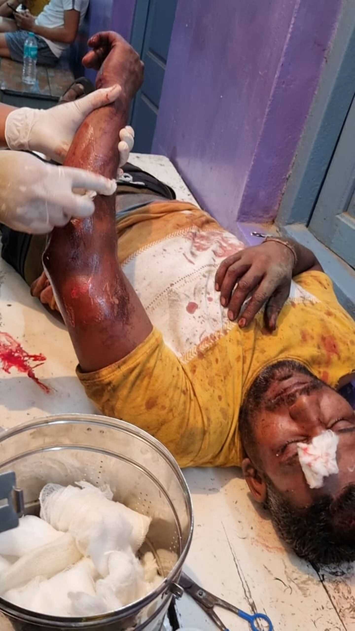 फल फ्रूट के पैसे मांगे तो दुकानदार पर किया जानलेवा हमला, आरोपियों पर विभिन्न धाराओं में प्रकरण दर्ज