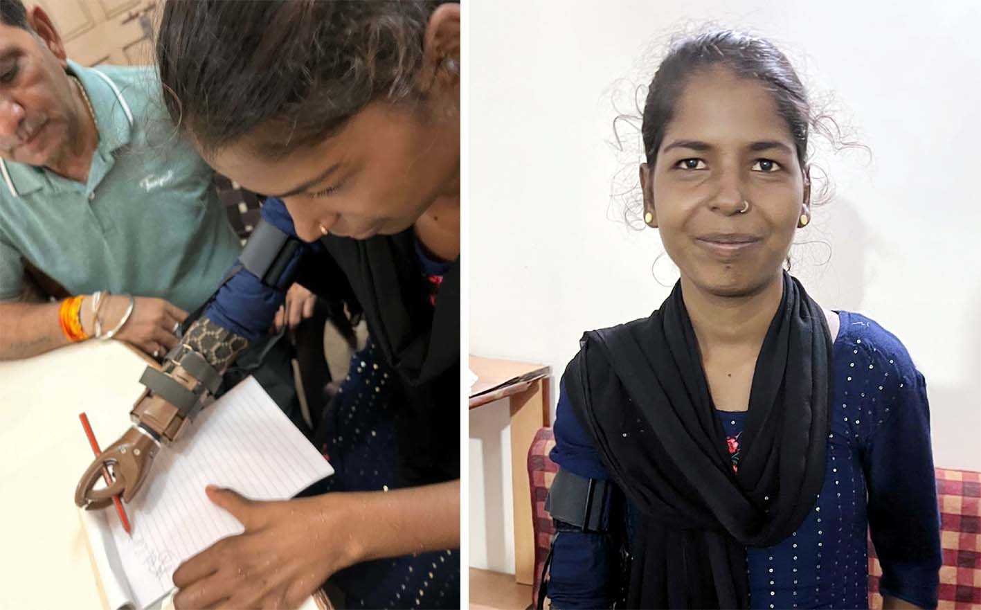 कृत्रिम हाथ लगते ही मुस्कान के चेहरे पर छाई खुशी