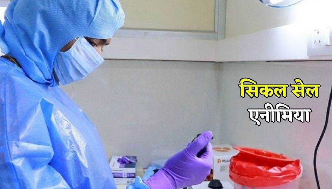 सिकल सेल एनीमिया की 23 लाख लोगों का टेस्ट, अब 33 जिलों में होगी बीमारी के पहचान के लिए जांच