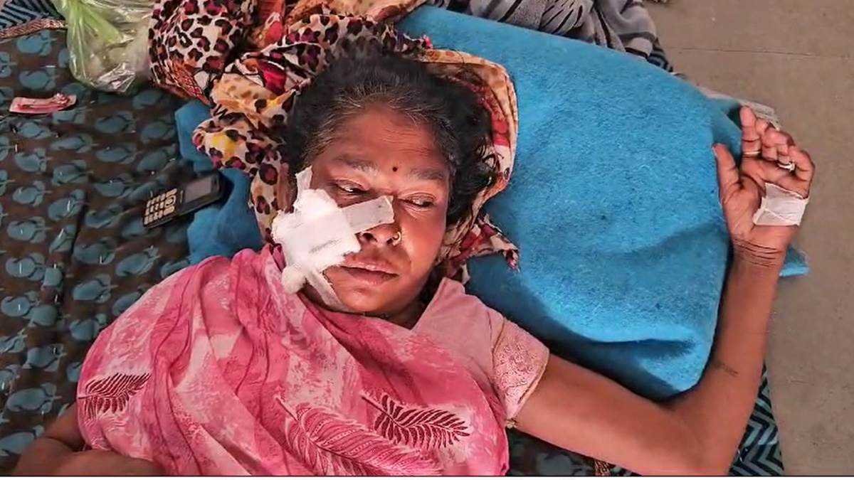 पागल श्वान ने प्रेमनगर में तीन लोगों को काटा, हालत गंभीर