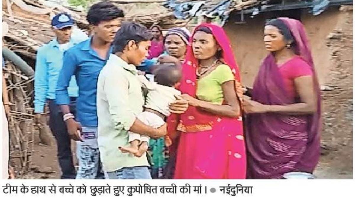 मां की हठधर्मिता के आगे प्रशासन मजबूर, कुपोषित बच्ची को अब घर पर ही दे रहे उपचार