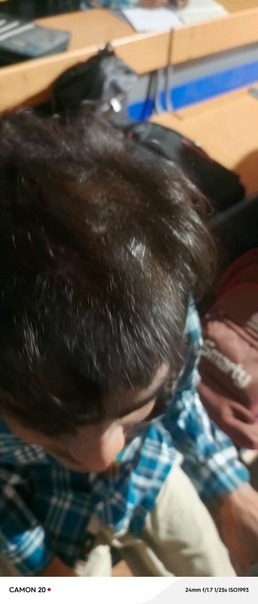 प्राचार्य का छात्रों से दुर्व्यवहार, सीएम राइस स्कूल के प्राचार्य ने लगभग 20 छात्रों के काटे बाल