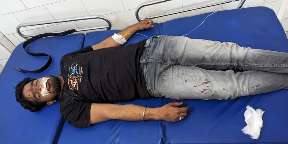 शादी से घर लौट रहे दो भाईयों से मारपीट-सड़क पर केक काटकर जन्मदिन मना रहे थे आरोपी