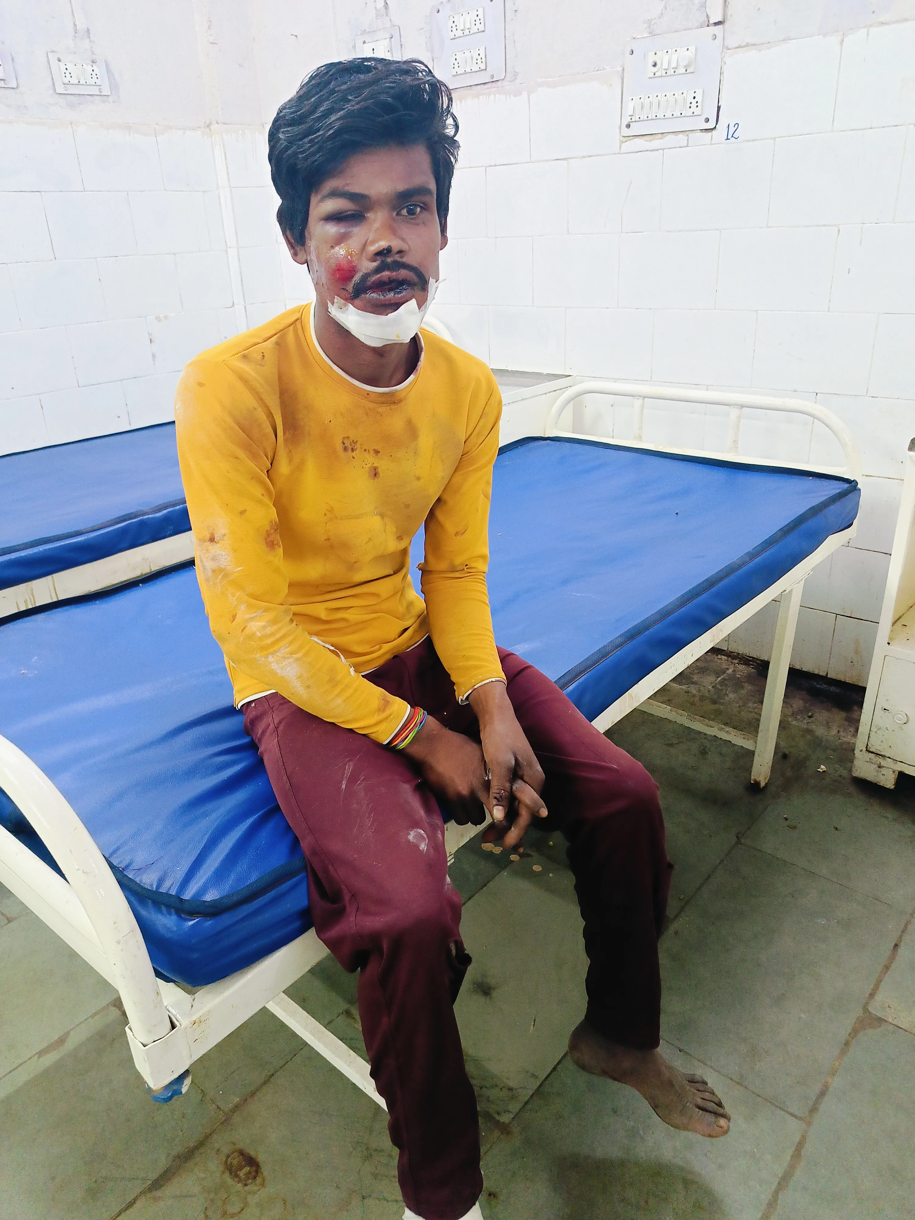 श्वान के बाईक से टकराने पर हुआ हादसा, पति-पत्नी घायल