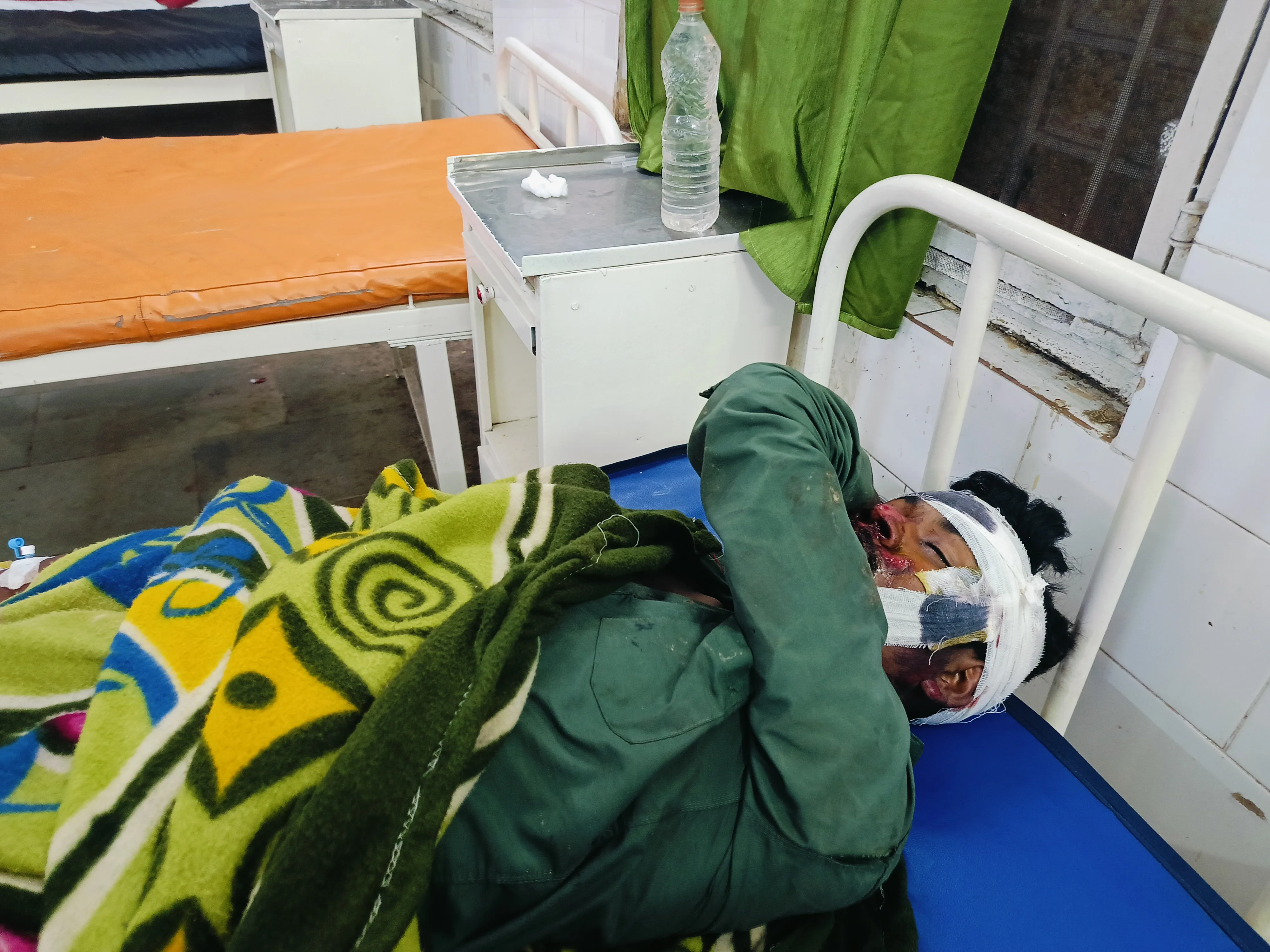 सड़क हादसे में चार घायल, एक के चेहरे पर आई गंभीर चोटे