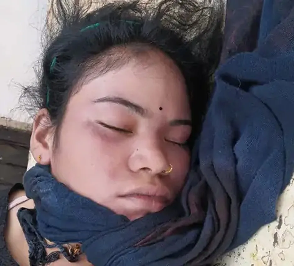 झुंडगांव में सर्पदंश से 19 वर्षीय युवती  की मौत