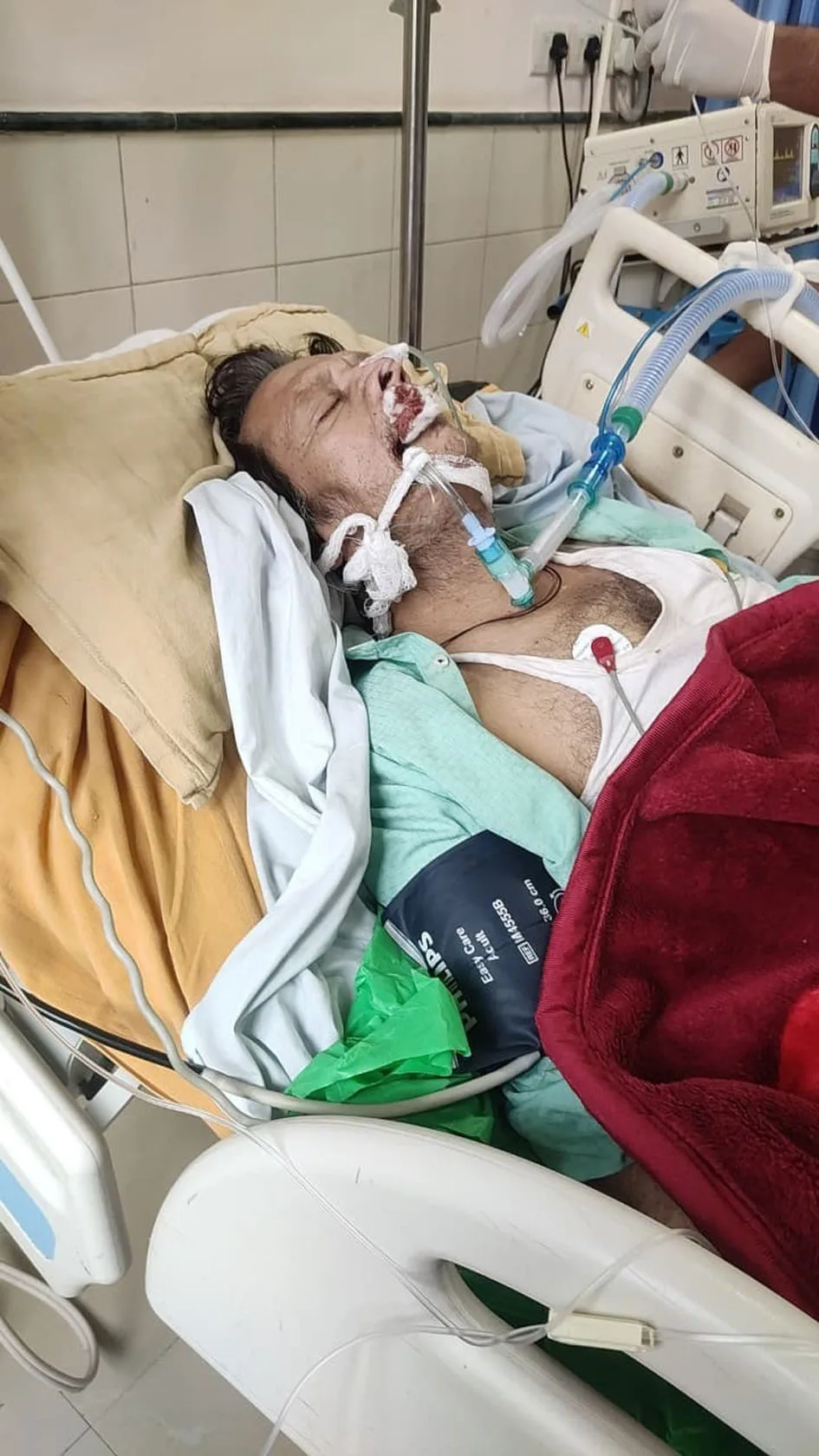 आयुष्मान योजना से रमेश पालीवाल को मिला नि:शुल्क उपचार