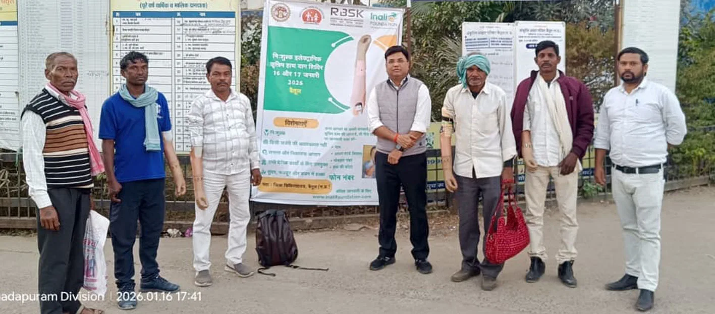 बिना हाथ वाले दिव्यांगों को लगाए जा रहे कृत्रिम इलेक्ट्रिक हैंड, दैनिक कार्य होंगे आसान